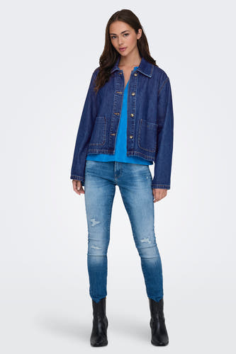 Jeansjas van donkerblauw denim van ONLY, met knoopsluiting en opgestikte zakken, gedragen met een blauwe top en destroyed jeans.
